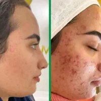 جوان سازی پوست خود را به ما بسپارید|آرایشی، بهداشتی، درمانی|اردبیل, |دیوار