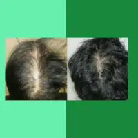 دوره تخصصی افزایش تراکم