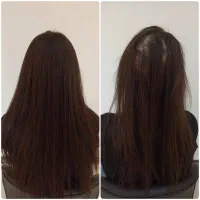 نمایندگی رسمی لاکچری کوین سرم سیرسیاه رویش مجددمو|آرایشی، بهداشتی، درمانی|قم, زنبیل آباد|دیوار