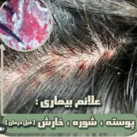 درمان تخصصی ریزش مو و رفع کم پشتی مو|خدمات آرایشگری و زیبایی|قم, صدوق|دیوار