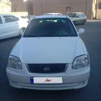 هیوندا ورنا دنده مدل ۸۶