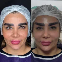 جراحی زیبایی|خدمات آرایشگری و زیبایی|تهران, سازمان برنامه جنوبی|دیوار