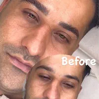 پاکسازی پوست میکروبلیدینگ ابرو اقایان شیدلب اقایان|خدمات آرایشگری و زیبایی|مشهد, هفت تیر (حافظ)|دیوار