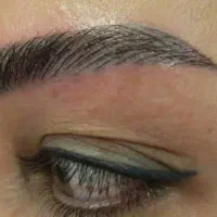 میکروبلیدینگ ومیکرو پیگمنتیشن