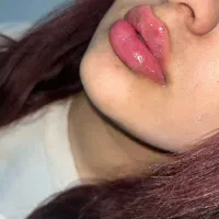 تزریقات تخصصی فیلر و بوتاکس|خدمات آرایشگری و زیبایی|مسجد سلیمان, |دیوار