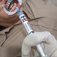 آموزش کامپوزیت دندان۱۰تومن|خدمات آموزشی|اهواز, رسالت|دیوار