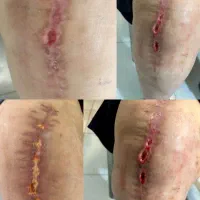 کلینیک تخصصی درمان زخم ( بستر و دیابت) فردوس|خدمات آرایشگری و زیبایی|اصفهان, بهار آزادی|دیوار