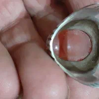 انگشتر دست ساز|جواهرات|اردبیل, |دیوار