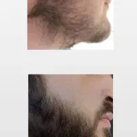 این خوراکی هارو برا ریشات میخوری