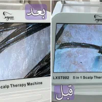 درمان قطعی شوره ،چربی،و انواع ریزش های مو|خدمات آرایشگری و زیبایی|اصفهان, چشمه باقرخان|دیوار