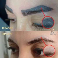 پاک کردن تتوابرو،خطچشم،خطلب(قسطی)