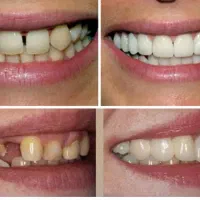 دندانپزشکی غرب تهران|خدمات آرایشگری و زیبایی|تهران, گلستان (شهرک راه آهن)|دیوار