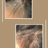 شارژ مجدد رویش