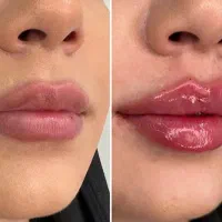 زیبایی|خدمات آرایشگری و زیبایی|کرج, فاز ۱ مهرشهر|دیوار