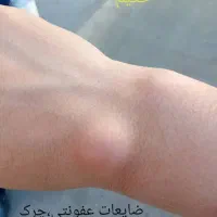 مرکز طب سنتی و شکسته‌بندی حکیم|خدمات آرایشگری و زیبایی|تهران, هفده شهریور|دیوار