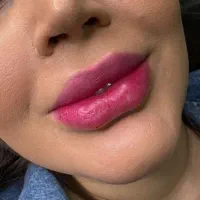 تزریق ژل بوتاکس لیفت مادلینگ و کانتورینگ کلینیک|خدمات آرایشگری و زیبایی|بندرعباس, |دیوار