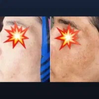 کرم ضدلک و روشن کننده درخشان