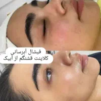 مدل  رایگان  فقط هزینه مواد مزوتراپی وفشیال و تتو|خدمات آرایشگری و زیبایی|فردیس, دهکده|دیوار