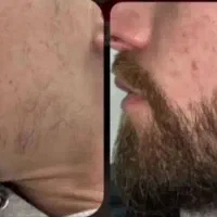 ریشت به توجه نیاز داره
