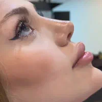 جراحی بینی
