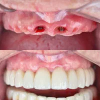 دندانپزشکی تخصصی ایمپلنت،لمینت،روکش دندان،ارتودنسی|خدمات آرایشگری و زیبایی|تبریز, |دیوار