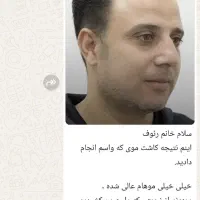 کاشت مو|خدمات آرایشگری و زیبایی|شیراز, قصرالدشت|دیوار