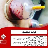 حجامت