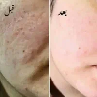 بهترین کرم vip|آرایشی، بهداشتی، درمانی|جیرفت, |دیوار