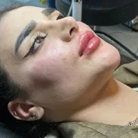تزریق ژل لب وکانتورینگ(+بوتاکس رایگان|خدمات آرایشگری و زیبایی|کرمانشاه, |دیوار