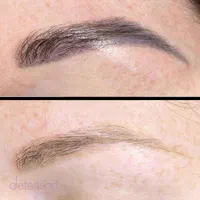 لیزر موهای زائد و الکترولیز|خدمات آرایشگری و زیبایی|فولادشهر, B5|دیوار