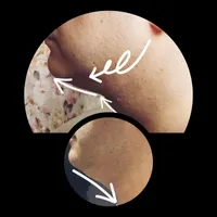 مرکز تخصصی لیپوساکشن غبغب|خدمات آرایشگری و زیبایی|تهران, پاسداران|دیوار