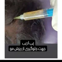 ژل وبوتاکس|خدمات آرایشگری و زیبایی|اهواز, پردیس دو|دیوار