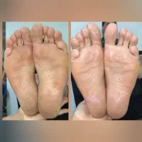 یه لحظه رد نکن بیا ببین پدیکور پارو|خدمات آرایشگری و زیبایی|محمدیه-قزوین, |دیوار