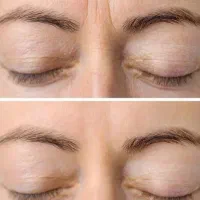 کرم بیوممتیک ایتالیایی گاتیو