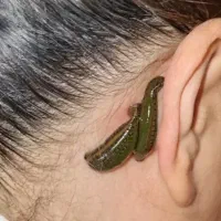 حجامت ،فصدوزالو،سم زدا ویونیزاسیون ماساژ درمانی|خدمات آرایشگری و زیبایی|سنندج, |دیوار