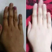 فرمول کرم ضدلک وسفیدکننده دست و صورت وبدن|آرایشی، بهداشتی، درمانی|ایرانشهر, |دیوار