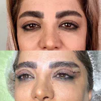 بلفارو چشم روباهی زیبایی