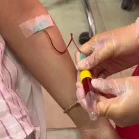 جشنواره تخفیف پی آر پی(PRP)/مزونیدلینگ مو و صورت