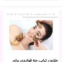 حلزون