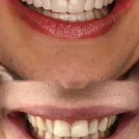تمامی خدمات دندانپزشکی و کامپوزیت و فیسینگ|خدمات آرایشگری و زیبایی|شیراز, فرهنگ شهر|دیوار