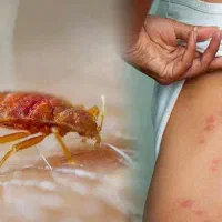 سمپاشی ساس در یک مرحله ضمانتی سم پاشی سوسک ریز