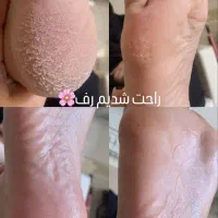 کاشت تخصصی ناخن واسپا (گلشهر)|خدمات آرایشگری و زیبایی|زنجان, |دیوار