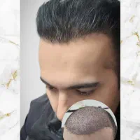 بازگشت موهای شما با ما