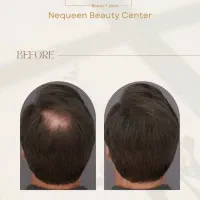 مرکز تخصصی زیبایی نکوئین|خدمات آرایشگری و زیبایی|تهران, کامرانیه|دیوار