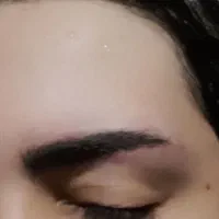 لیزر پاک کردن تاتو بدن و صورت|خدمات آرایشگری و زیبایی|محمدشهر, محمدشهر|دیوار