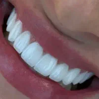 مرکز تخصصی زیبایی دندان در دو‌شعبه ورامین وتهران‌|خدمات آرایشگری و زیبایی|قرچک, مهدیه|دیوار