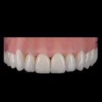 استخدام کارآموز خانم در لابراتوار تخصصی دندانسازی