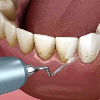 جرمگیری 2فک 1/490