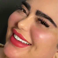 بوتاکس فیلرژل لب گونه چانه زاویه فک و صورت مادلینگ|خدمات آرایشگری و زیبایی|تهران, تهرانپارس غربی|دیوار