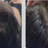 تزریق ژل،بوتاکس،سابسیژن،پی آرپی،مطب درمانی وزیبایی|خدمات آرایشگری و زیبایی|خرم‌آباد, |دیوار